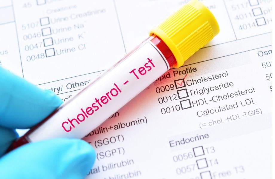 Cholesterol 700 na keto i zero blaszki - co to znaczy?